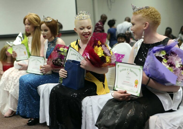 Albinism pageant in Zimbabwe joyfully breaks down prejudice